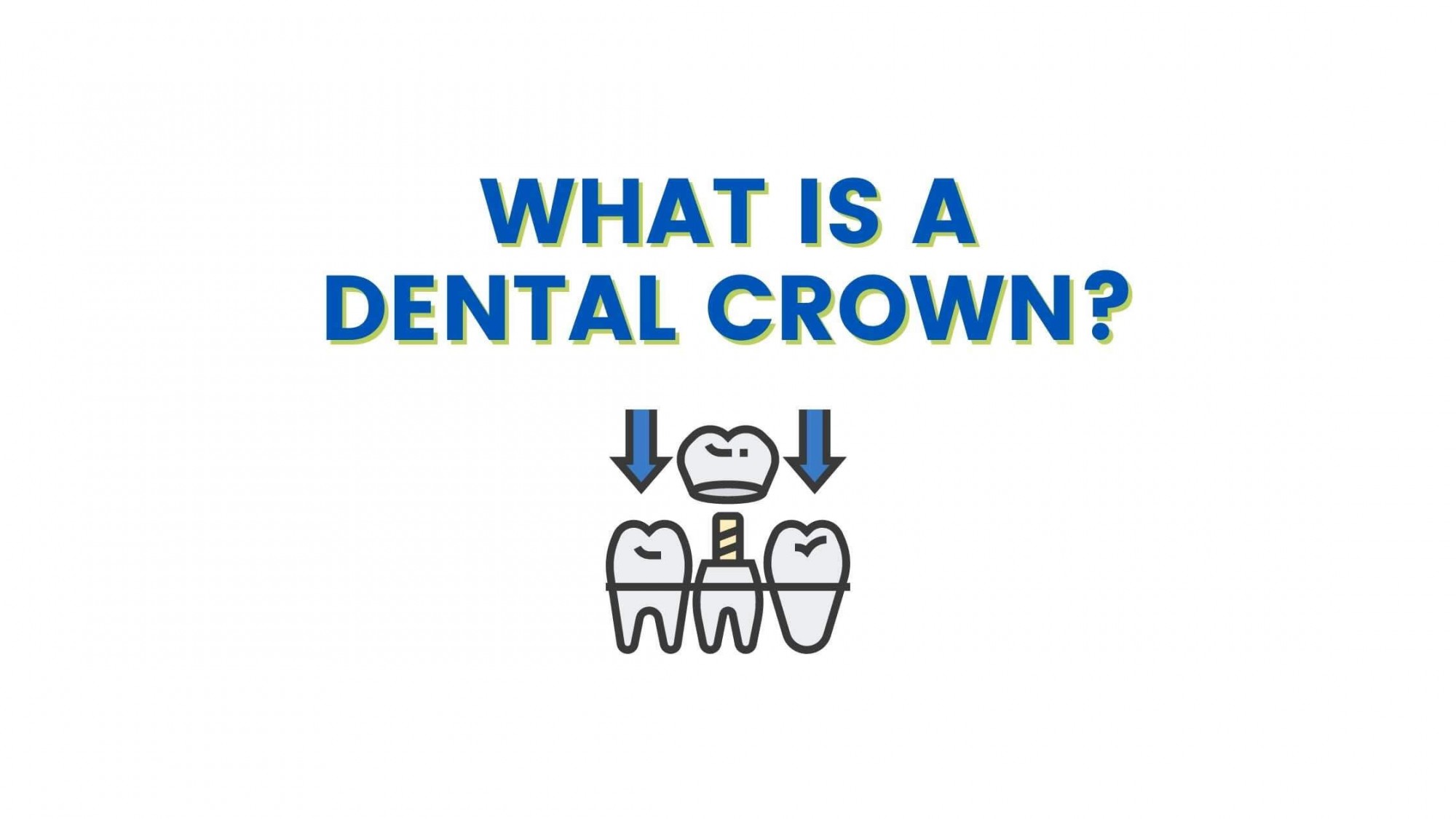 What is a Dental Crown | Dental Crown Procedure Explained