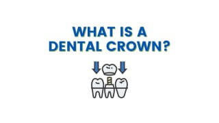 What is a Dental Crown | Dental Crown Procedure Explained
