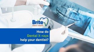 How do Dental Xrays help the dentist?