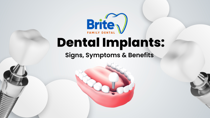 Dental Implants: Signs, Symptoms & Benefits