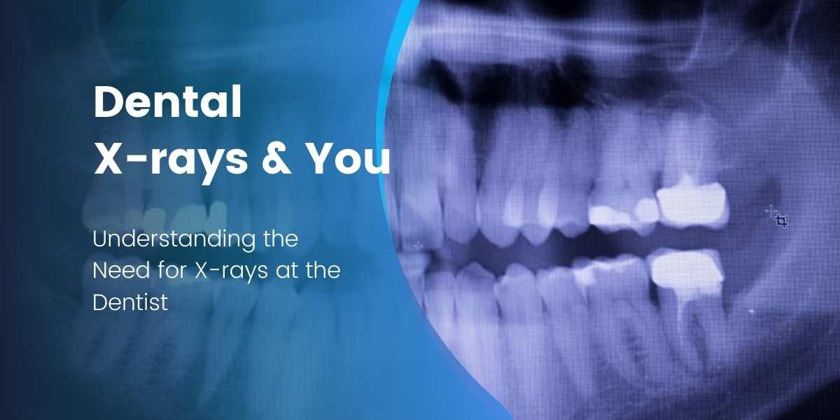Why do I need an X-ray when I go to the dentist?