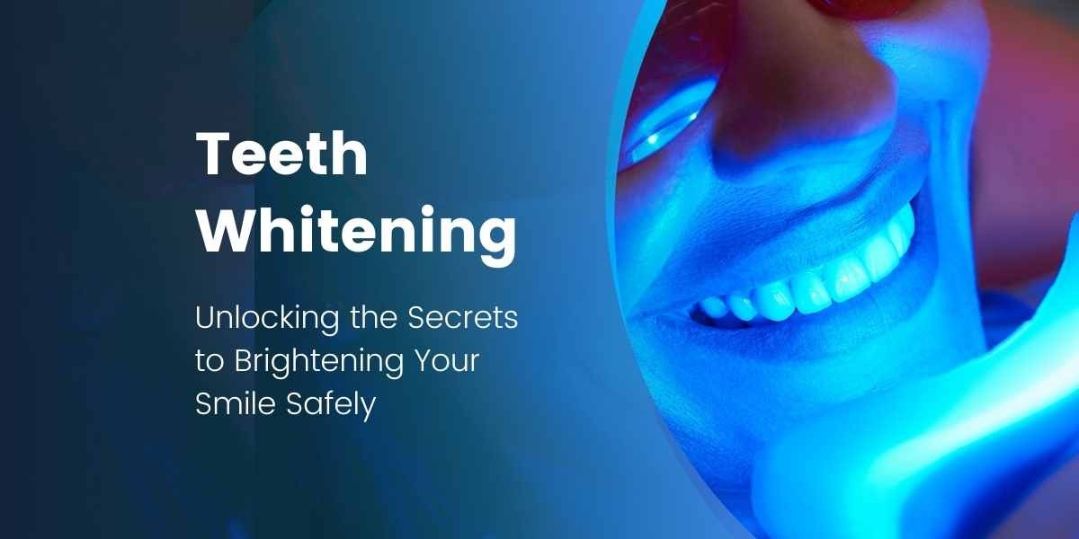 Unlocking the Secrets of Teeth Whitening: Brightening Your Smile Safely